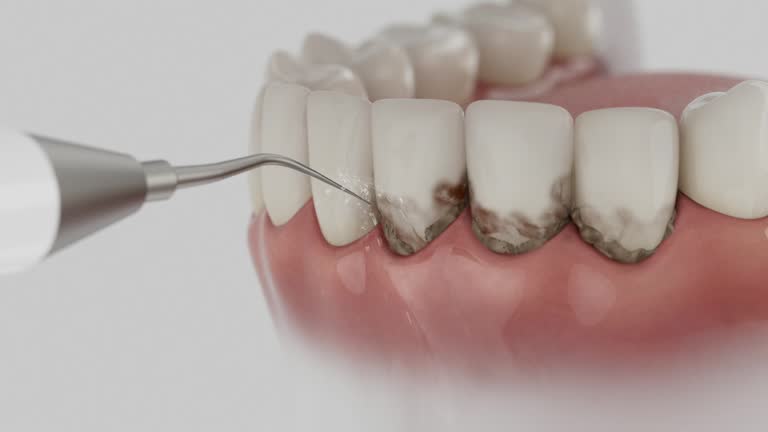 Trusted Root Canal Treatment service in Catoosa, OK - Dentist Open Now